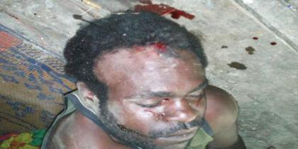 Yemi Pakage (16) terbunuh misterius di Wagethe, Sabtu, 1 Juni 2013 lalu. Foto: Ist