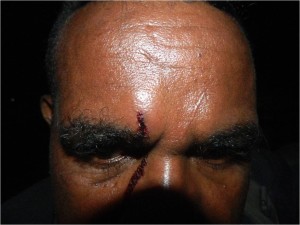 Pendeta Delvian Iyai (38), korban pemukulan oknum anggota TNI (Foto: Yones Douw)