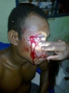 Welem Merani, salah satu korban penganiayaan (IST)